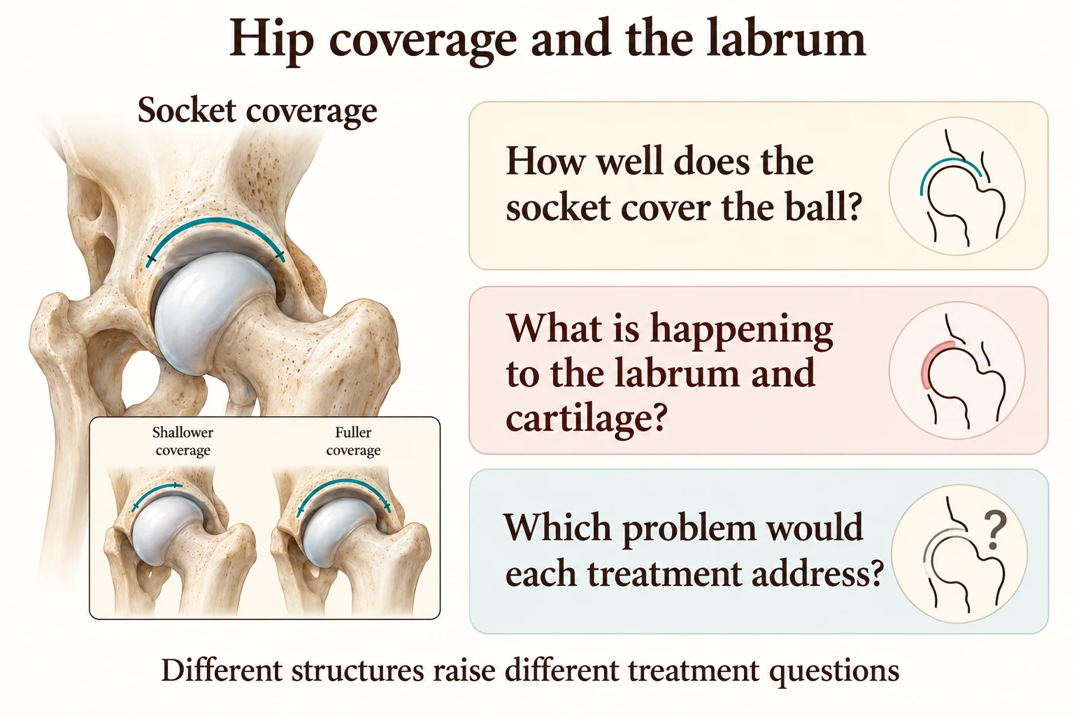 A hip socket-coverage schematic sits beside questions about coverage, labrum, cartilage and treatment purpose.